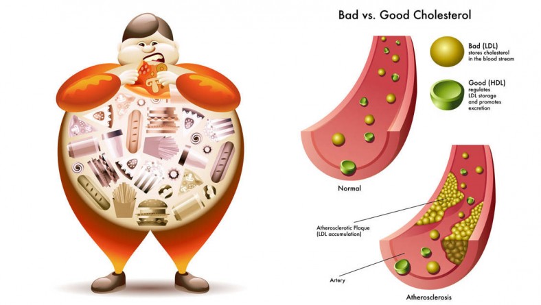 TIPS TO CONTROL YOUR CHOLESTEROL LEVEL